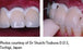 AL FAYROUZ MEDICAL EQUIPMENTS TRADING Glass ionomer luting cement -Riva Luting Glass ionomer luting cement