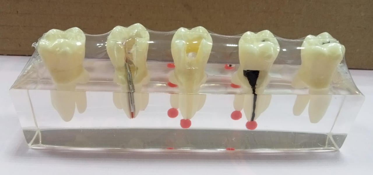 TOOTH MODEL