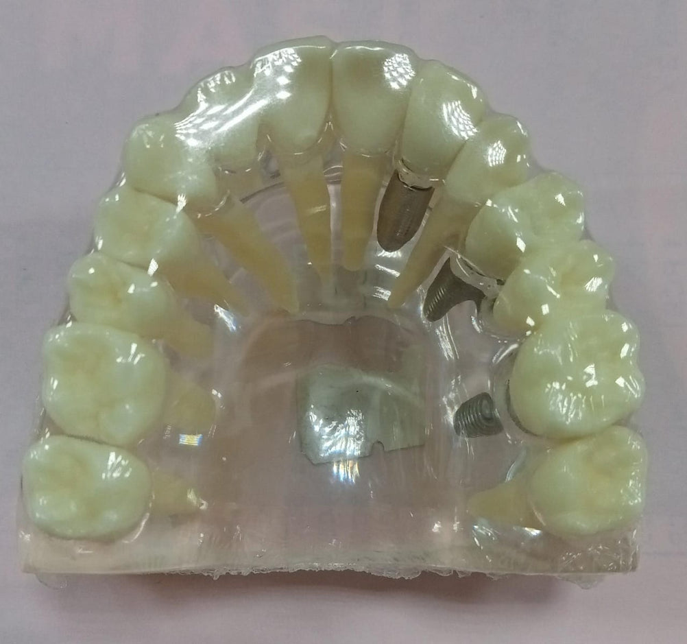 TOOTH MODEL