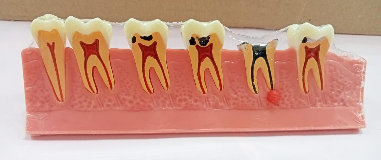 TOOTH MODEL