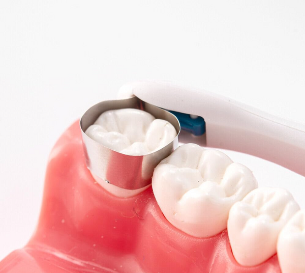 Dental Pro Matrix Bands