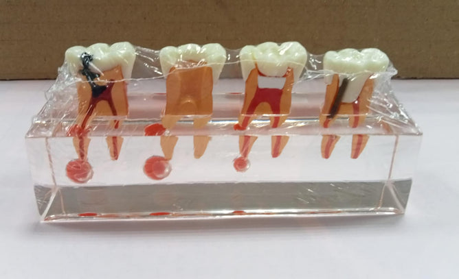 Working Model Tooth TOOTH MODEL