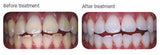 AL FAYROUZ MEDICAL EQUIPMENTS TRADING 235.00 dental material AL FAYROUZ MEDICAL EQUIPMENTS TRADING Pola Office dental supplier dubai